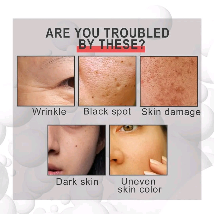 Botox krem