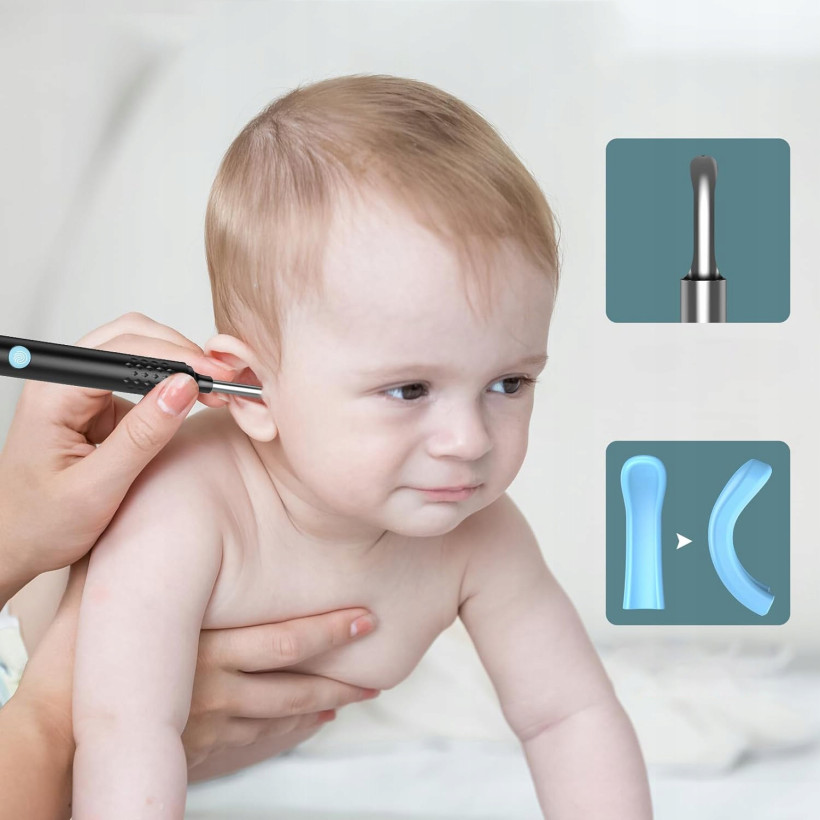 SMART OTOSKOP DO CZYSZCZENIA USZU WOSKU KAMERA WIFI APP ANDROID IOS LED